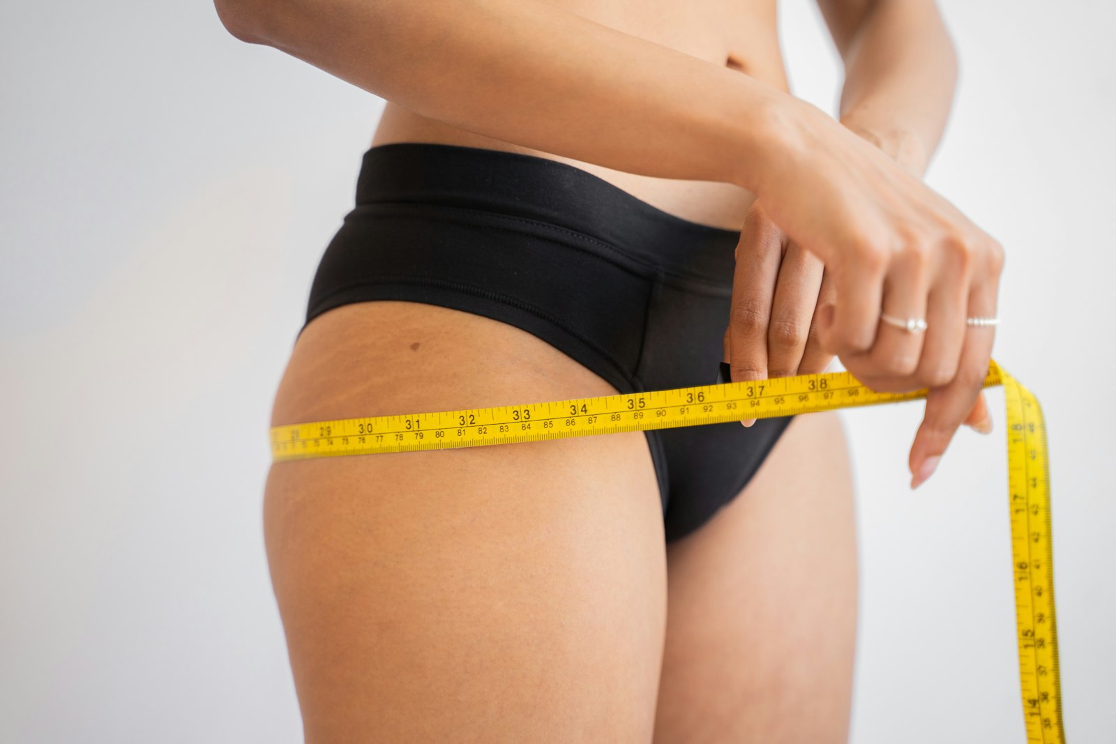 Body Lift - Dr. José Linares cirujano plástico en Rosario